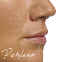 http://www.discreetaesthetics.co.uk/Content/images/comparison/dermalfiller2after.jpg